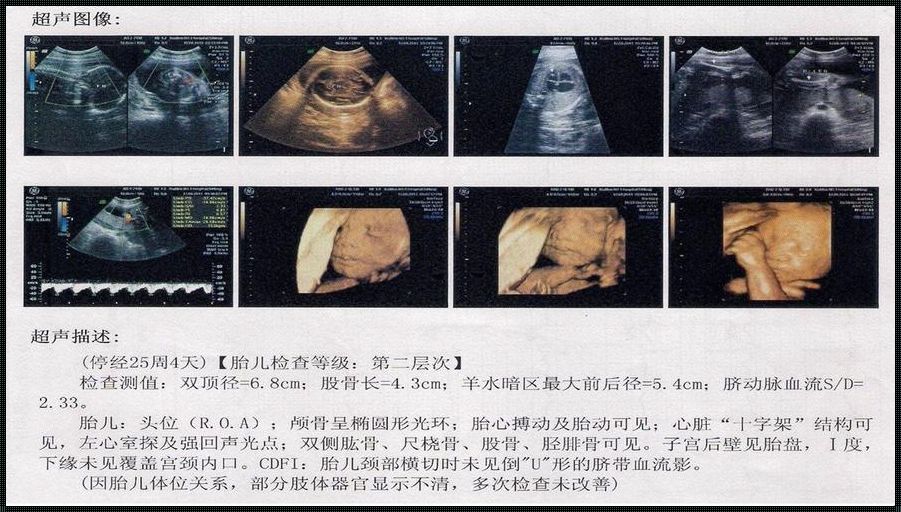 关于B超空腹的探讨：真实体验与深刻见解