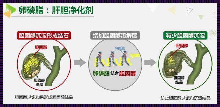 卵磷脂与胆固醇的深情对话：揭秘二者间的奥秘