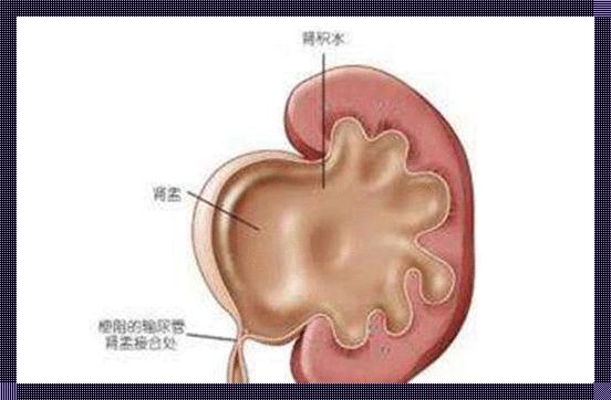 怀孕30周，胎儿左肾盂分离8mm：我的亲身经历与应对小技巧