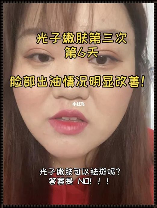 脸部油腻的破解之道：美容见解分享