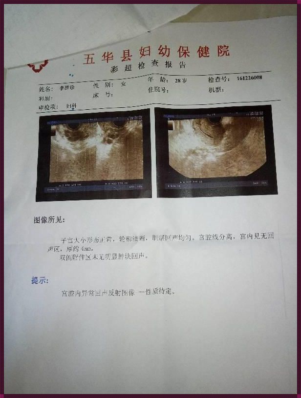 引产后一个月同房后少量出血：我的真实体验与深入剖析