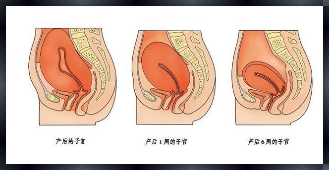 引产后子宫恢复不好，我的历程与反思