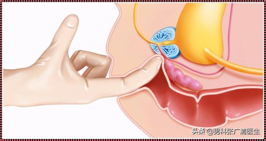 前列腺液会让人怀孕吗？——揭秘生活中的疑惑