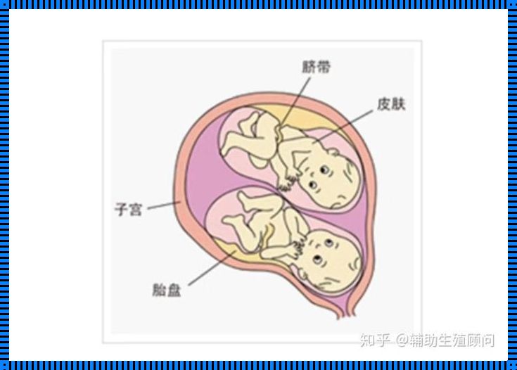 异卵双生：性别相同的奇妙现象