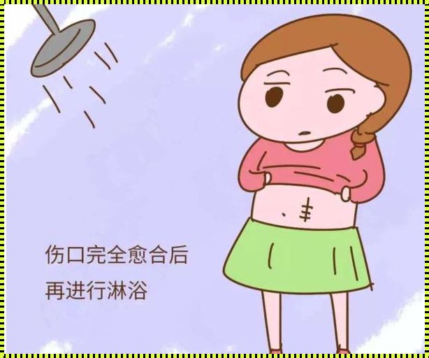 产后恢复的关键时刻：剖腹产后多久可以碰生水？