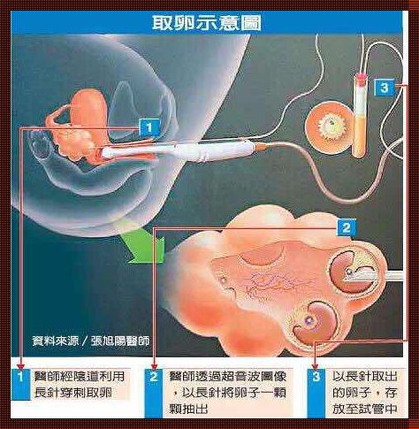 女人的卵怎么排出来的秘密揭示