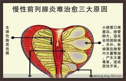 前列腺炎每周要排精吗？探讨这一火爆话题背后的真相