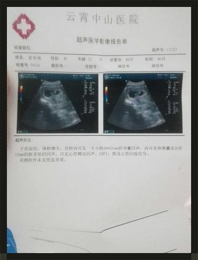 孕囊31mmx21mm是怀孕多久：探究与情感的交织