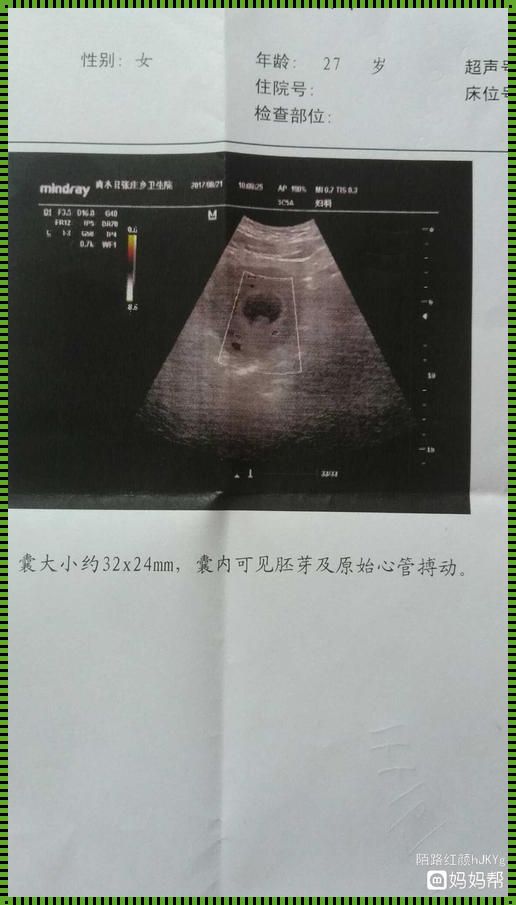 彩超能查出怀孕几周吗？揭秘胎儿成长早期的神秘面纱