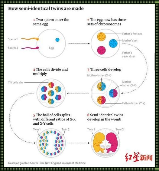 揭开神秘面纱：异卵双胞胎的危害
