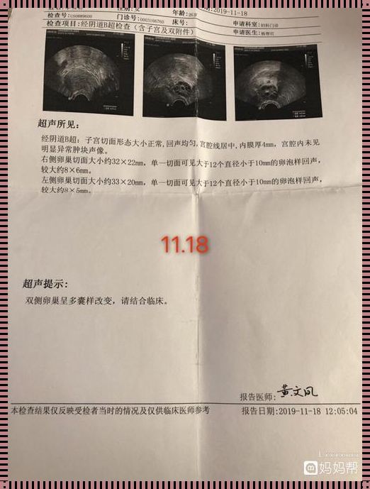 卵泡15×13隔一天后没有了：惊现生理之谜