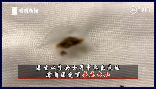 剖腹产后耳朵听不见了：一位母亲的惊险经历