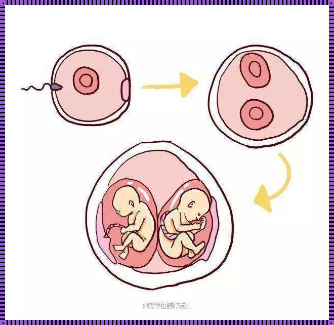 单卵双胎的奇迹：没有双胎基因的我怀了双胞胎