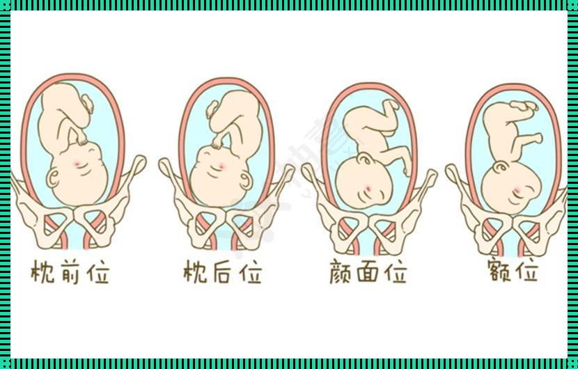 ROAROP胎位：探秘生命之初的位置之谜