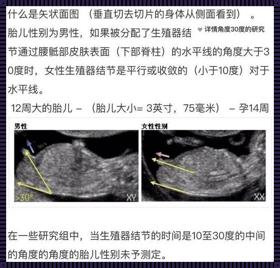 孕16周胎儿男女凸起区别：探索生命的奥秘