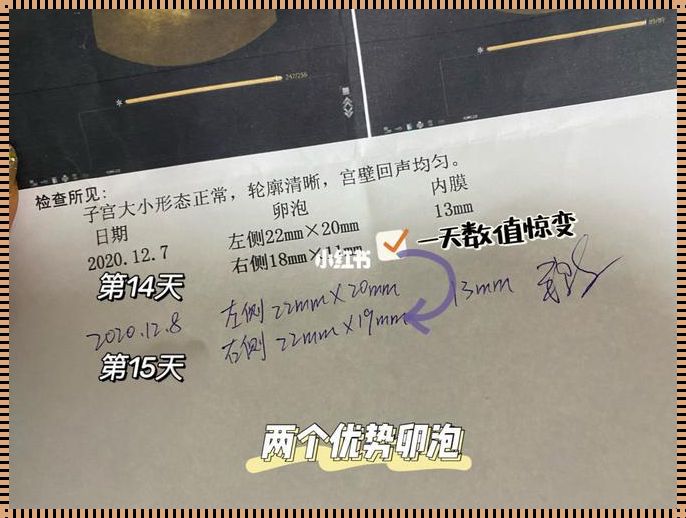 2个优势卵泡一定双胞胎吗？揭秘多胞胎的奥秘