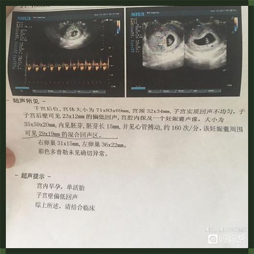 孕囊看男女是6周准还是8周准：探寻孕期性别鉴定的科学奥秘