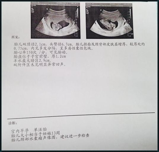 5个月引产后多久复查最合适