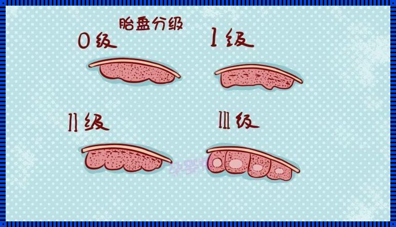 孕12周胎盘厚度对照表：揭秘宝宝成长的秘密