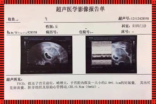 31周怎么看胎儿身高多少：揭秘胎儿生长的妙招