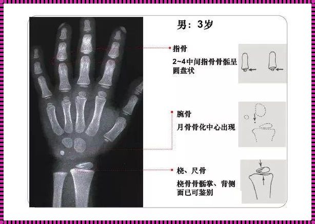 儿童骨化核对照表：成长里程碑的解读