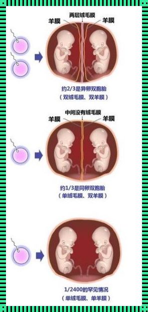 单绒双羊多少周生最好：探讨孕期护理与注意事项