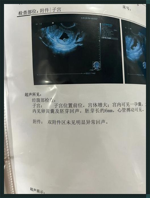 未见卵黄囊及胚芽怎么处理：关注与深思