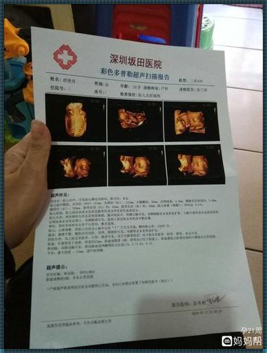 20天彩超能看出怀孕吗？揭秘神秘面纱下的真相