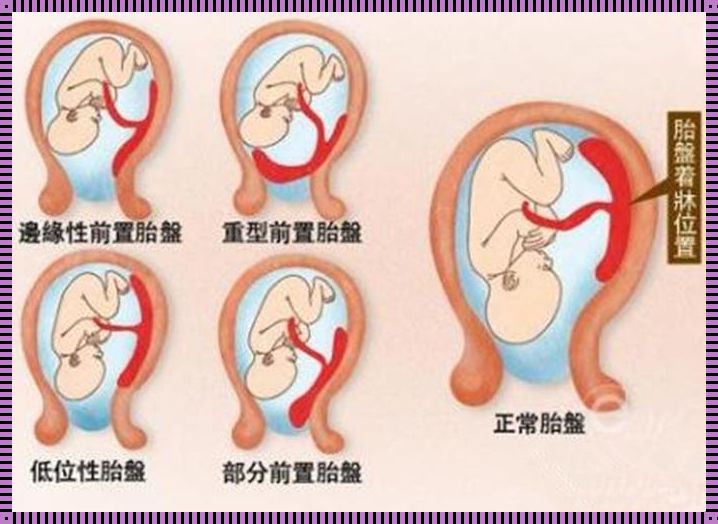 17周胎盘2级：火爆背后的深度解读