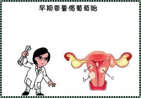 葡萄胎再次备孕查哪些：重新踏上孕育之路