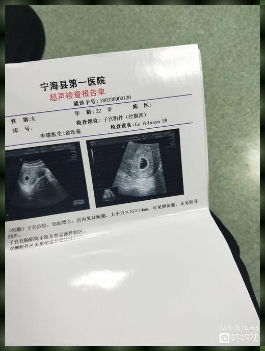 孕6周的反应到7周突然消失：惊喜还是惊吓？