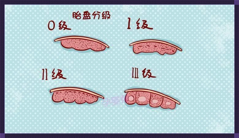 胎盘呈2级是什么意思