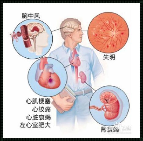 高血压对胎儿的影响有哪些