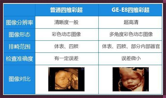 四维价格不一样有什么区别