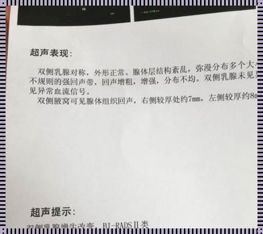 两家医院b超结果不一样，差距大：揭秘