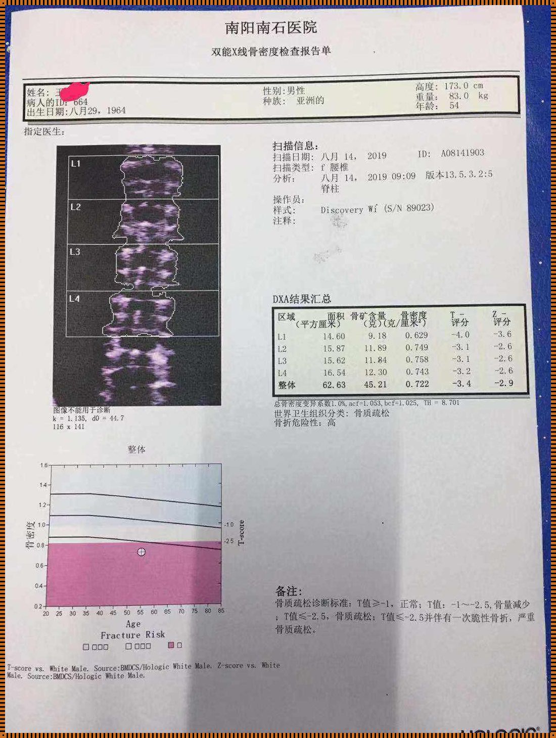 中年人骨密度检测的重要性和影响