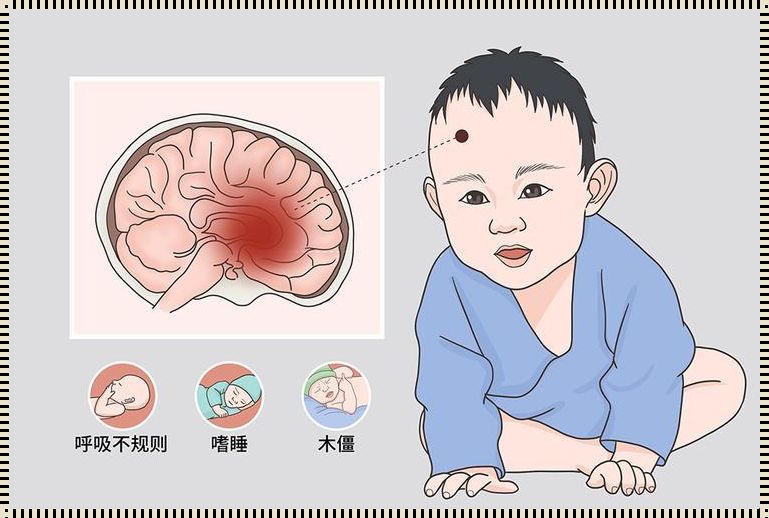 新生儿脑出血怎么判断：守护宝宝健康的秘诀