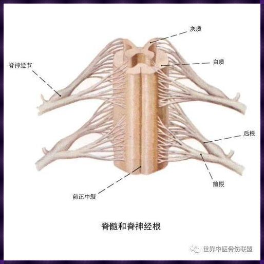 脊髓根神经炎：揭秘其表现与治疗