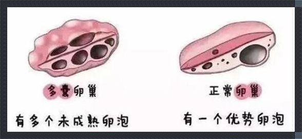 儿童卵泡发育的影响探究