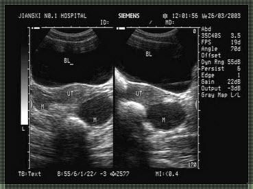 子宫附件彩超检查什么：揭开神秘面纱