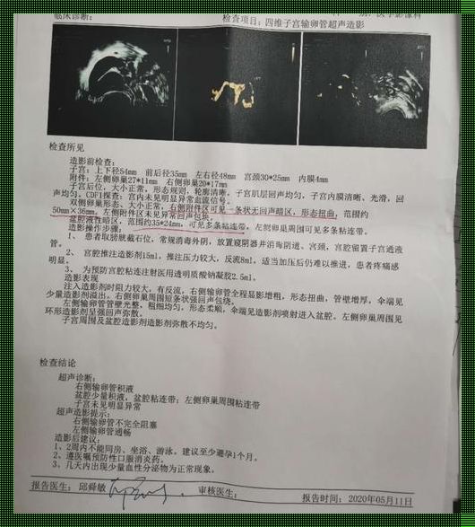 阴超感染案例分析：当前状况与未来展望