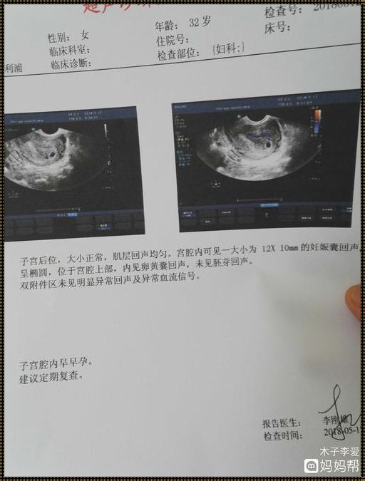 怀孕5周突然身体感觉轻松了解原因令人感慨