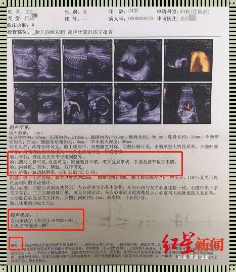 四维B超报告单：生命的奇迹分享