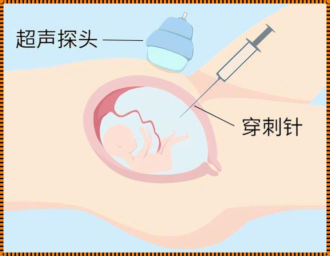 羊水穿刺适合多少周做：揭秘母婴健康的重要步骤