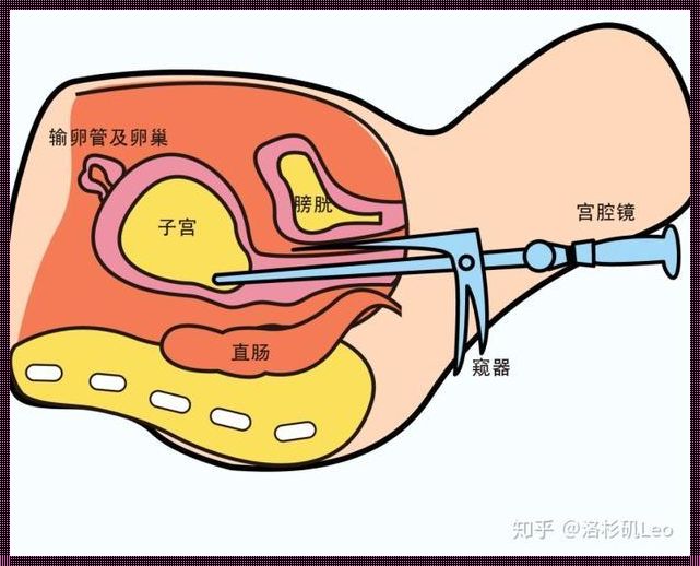 通输卵管去哪家医院最好：为生育之路护航