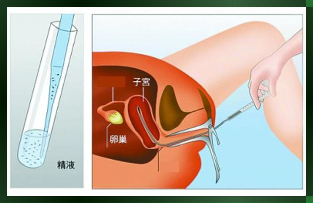 做完事之后怎么知道有没有怀孕