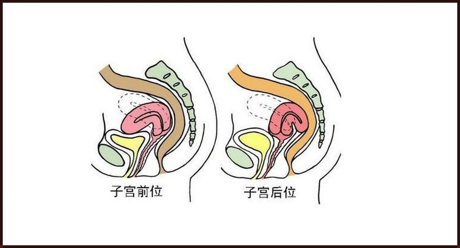 站着容易怀孕吗？——探寻站立姿势与怀孕概率的关联