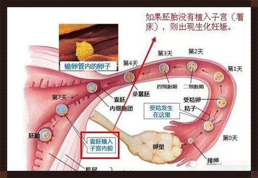 怎么区别生化妊娠和宫外孕