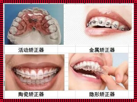 矫正牙齿的最佳方法