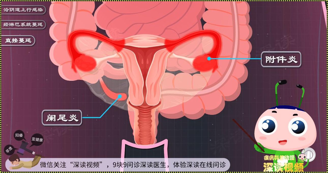 输卵管炎在哪个部位疼：探秘女性生殖系统的奥秘